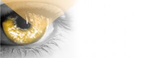 Cataract disposable set - 5 sterile units