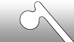 Phaco chopper titanium handle length 120 mm